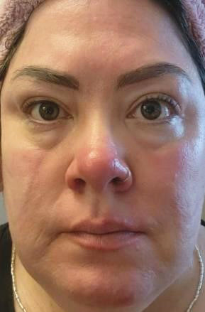 Wunderset schöne Haut Neuro Rescue in groß für die nervöse, gerötete Haut und Rosazea