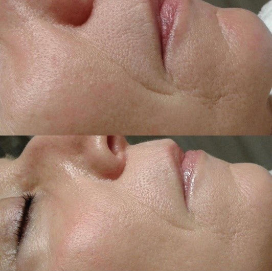 4-Wochen Wunderset bei Falten und Spannkraftverlust